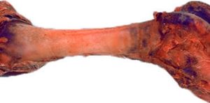Lårgensknogle XL